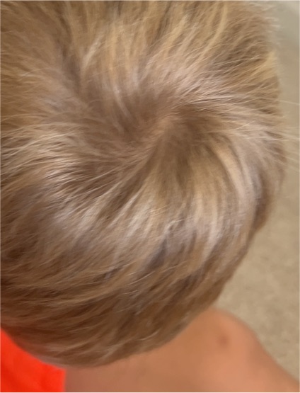 Vintage Doll Wig Blonde Synthetic Fiber Hair Size 8-9 — front
