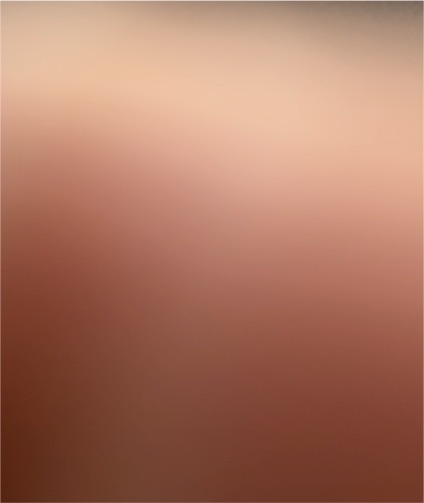 2011 Topps Precision #238 — front