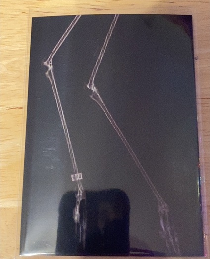 2024 Topps Allen & Ginter #XR-16 Greater Flamingo Legs X-ray'd — front