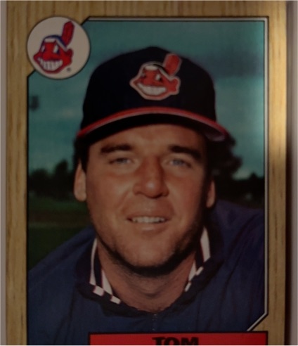 1987 Topps #657 Tom Waddell — front