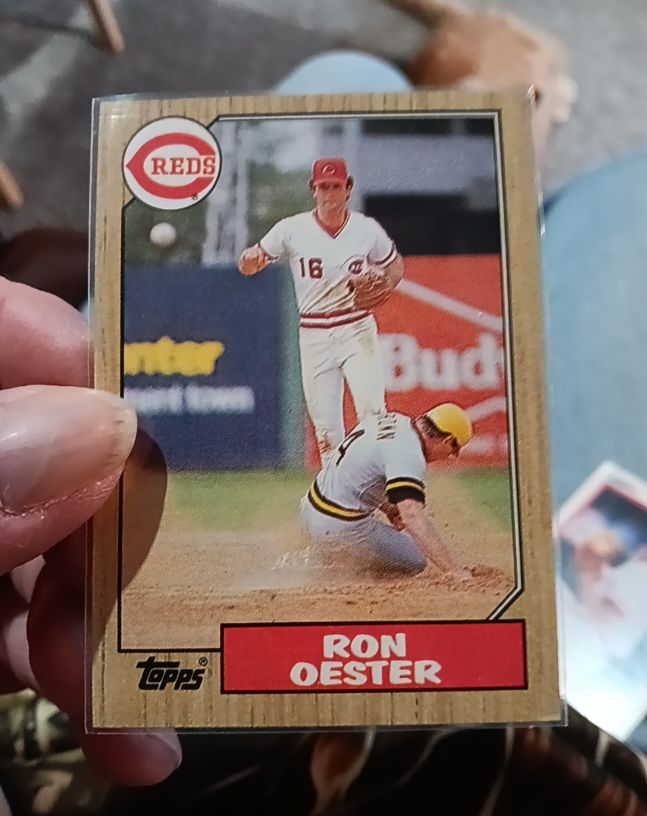 1987 Topps #172 Ron Oester — front
