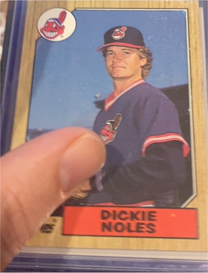 1987 Topps #244 Dickie Noles — front